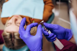 Gloved hands preparing dental instrument for root canal with patient in background